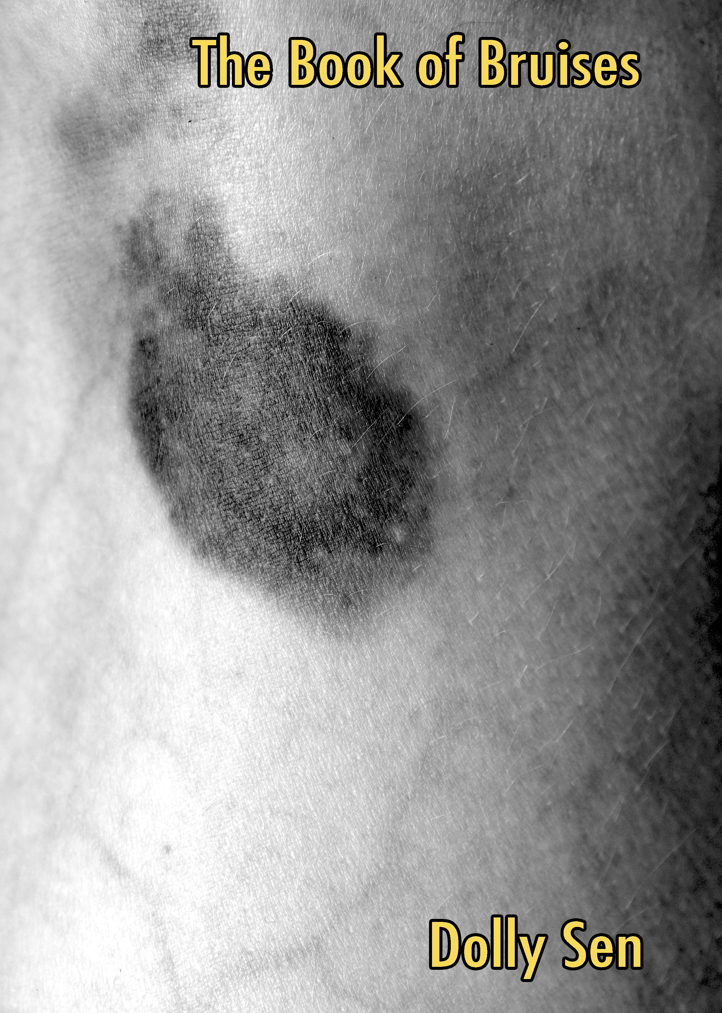 The release of Book of Bruises, my latest publication